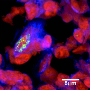 Microsopic picture of biofilms